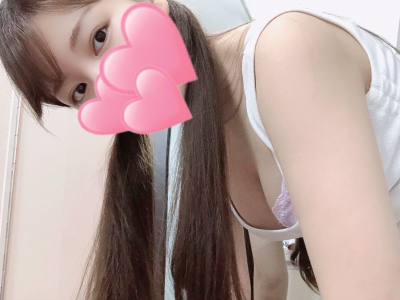 ヤケド・・😭✌️(泣)